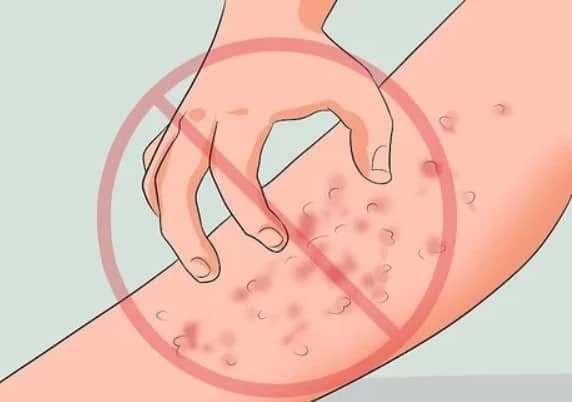 How to Soothe Irritated Skin After Nair